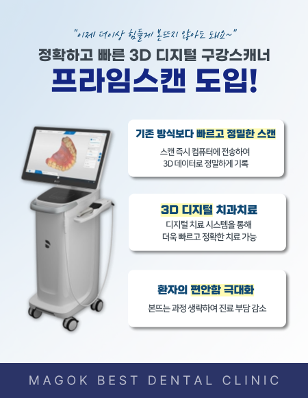 새단장 1주년 이벤트