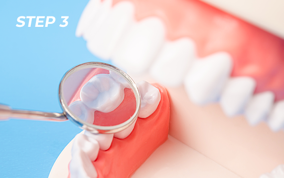 치석 및 염증 제거