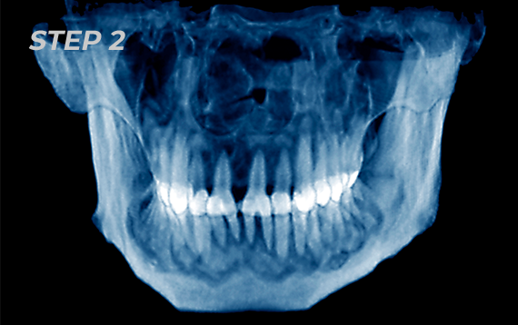 3D CT 촬영 및 문진표 작성