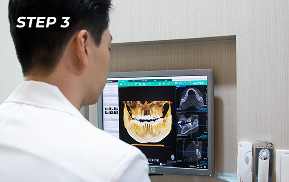 모의 수술 및 가이드 제작