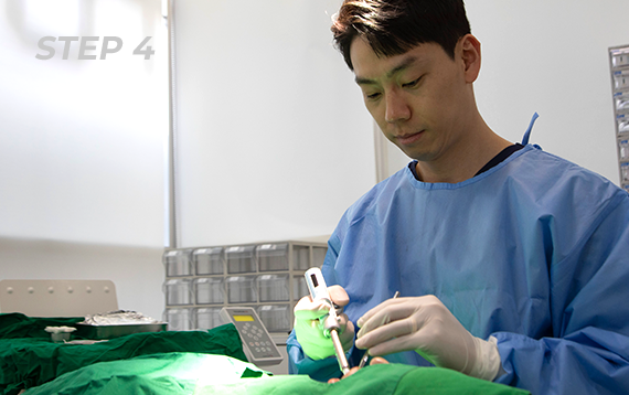 가이드를 이용한 수술