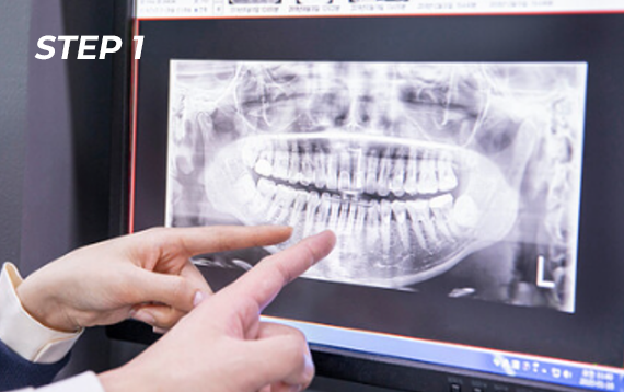 정밀 진단 장비를 통한 진단