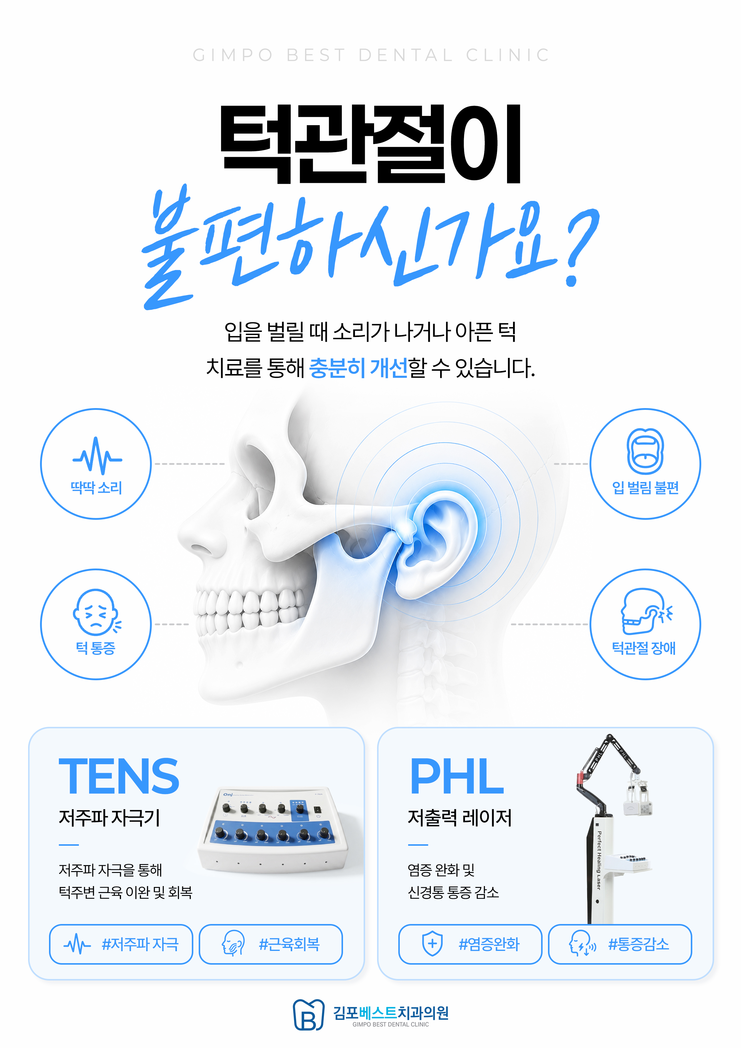 턱관절기기 도입 팝업